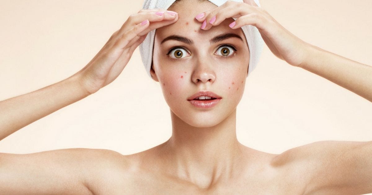 boutons_sur_visage